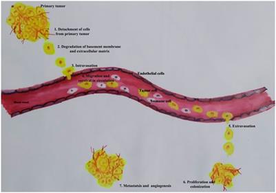 Insights Into the Role of Matrix Metalloproteinases in Cancer and its Various Therapeutic Aspects: A Review